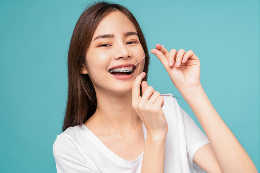 Niềng răng thẩm mỹ
